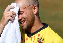 Watch Video | Australian player Ashton Agar got injured Ashton Agar injured